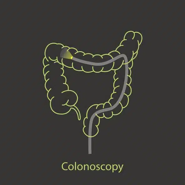 Super Funny Colonoscopy Puns to Enjoy 