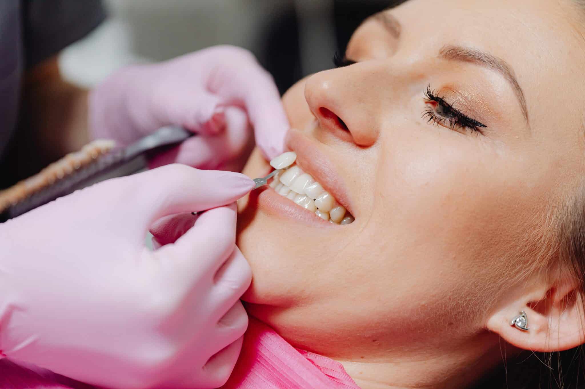 Important Tips Before Getting Porcelain Veneers Important Tips Before Getting Porcelain Veneers