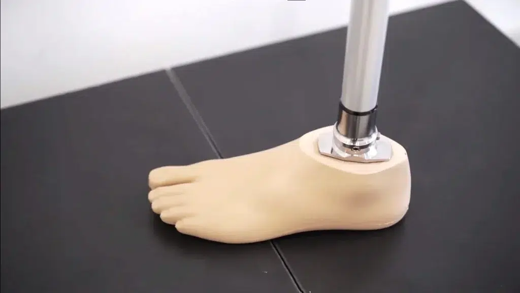 Functional advantages of toe prosthetics supported by adaptive socket systems