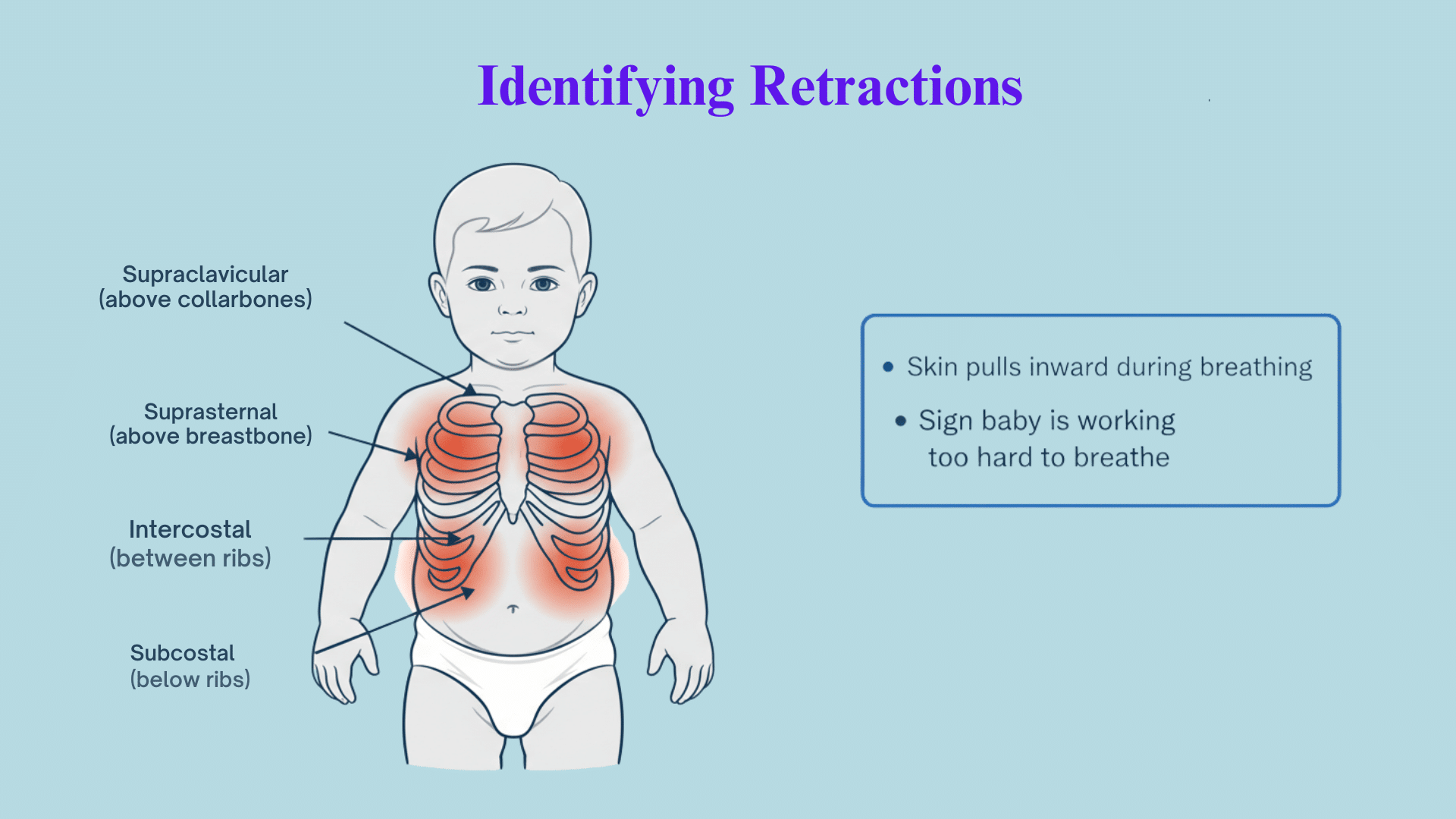 How to Identify Retractions in Babies