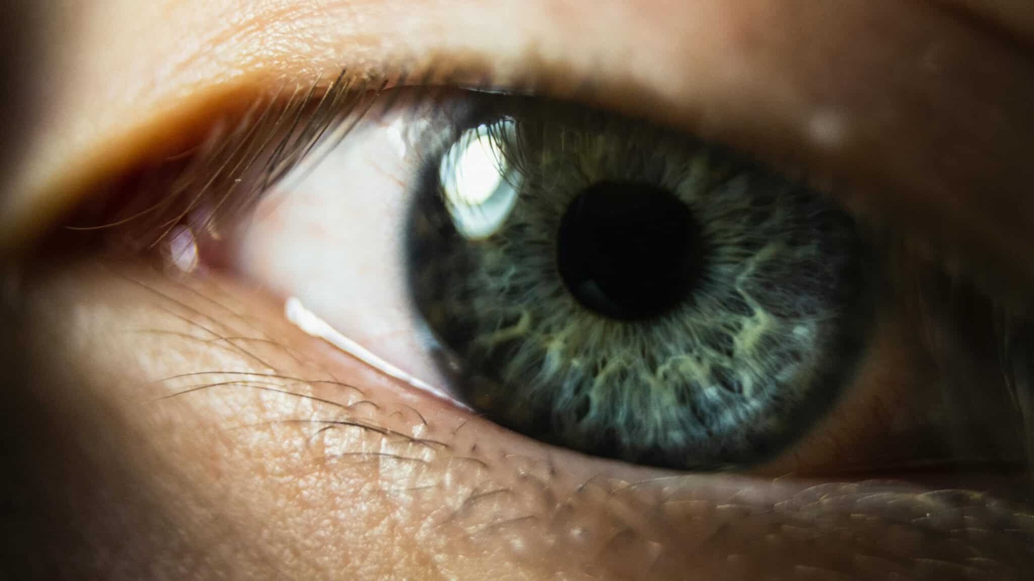Dry Eyes and Existing Eye Conditions